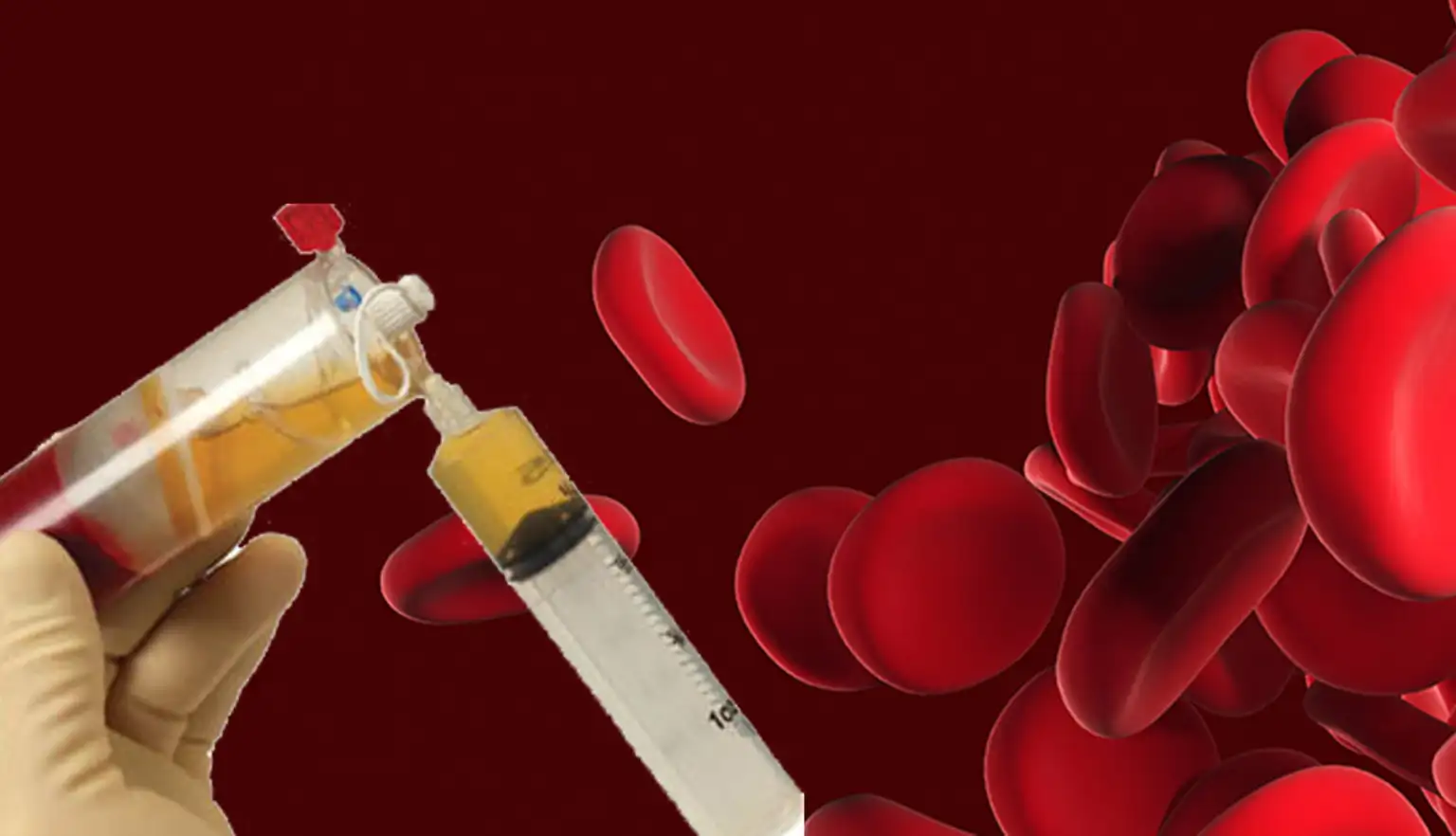 What is Platelet Rich Plasma Treatment, and How It Works_
