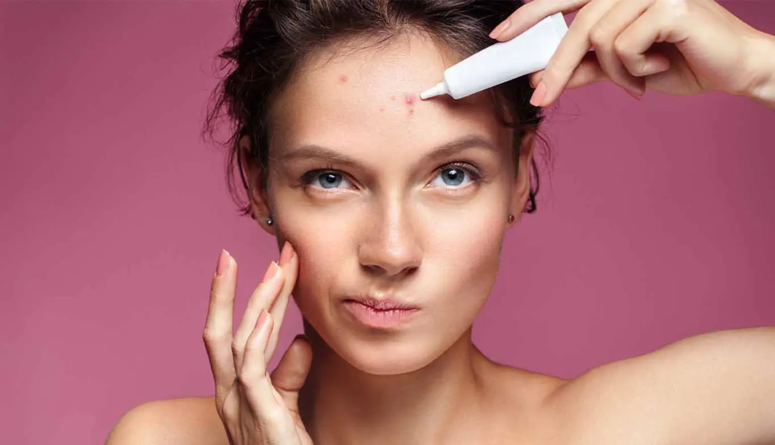 What is the Permanent Treatment for Acne_